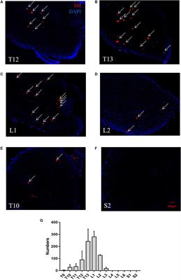 Distribution, Morphological Characterization, and Resiniferatoxin-Susceptibility of Sensory Neurons That Innervate Rat Perirenal Adipose Tissue